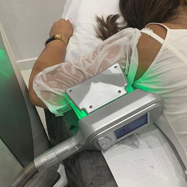 Cryolipolyse behandelingen